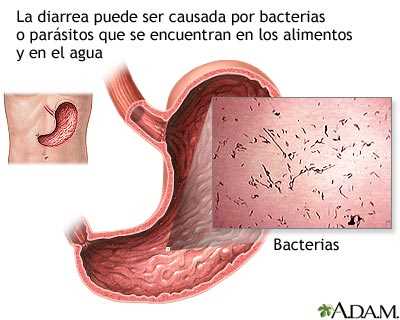 Las posibles causas de la diarrea